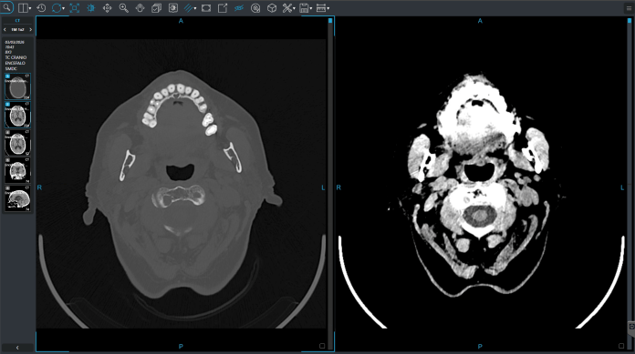 demo-viewer2